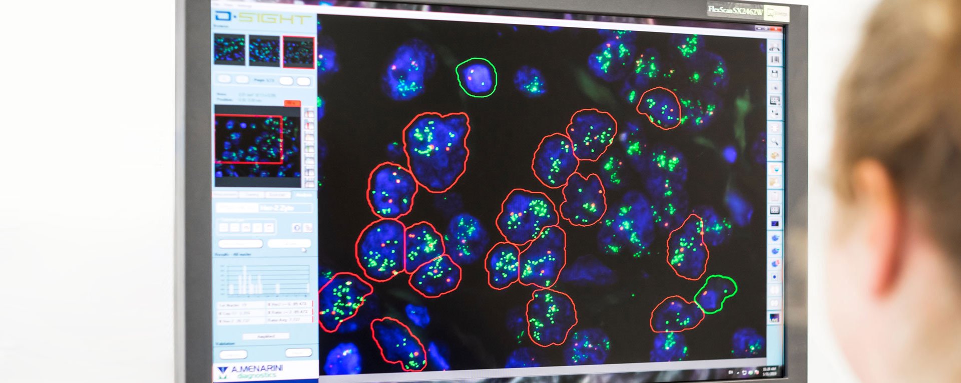 Mitarbeiterin der Pathologie an einem Bildschirm im neuen molekularpathologischen Labor in Kempten