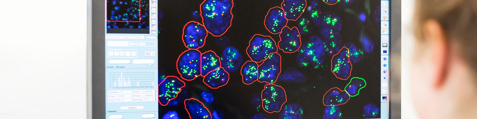 Mitarbeiterin der Pathologie an einem Bildschirm im neuen molekularpathologischen Labor in Kempten